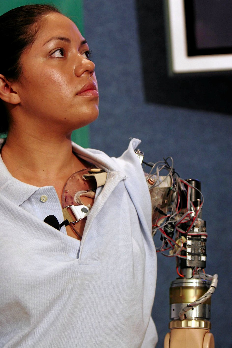 Cyborg, blanding af robot og menneske, er allerede virkelighed. Claudia Mitchell er verdens første såkaldte bioniske kvinde, der har fået indopereret en robotarm, som kan styres med tankerne. –