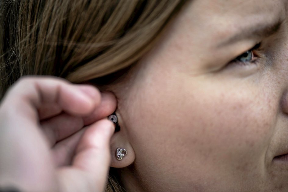 I det ene øre hører Amalie Mellin sin tinnitus som en hylen, i det andet som en dyb susen. En såkaldt tinnitusmaske i ørerne hjælper hende med at neutralisere støjen. —