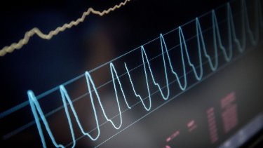 I en ny holdningsundersøgelse fra Sundhedsstyrelsen svarer 84 procent af danskere over 15 år, at de har en positiv eller meget positiv holdning til organdonation.